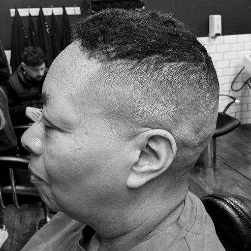 Skin fade
